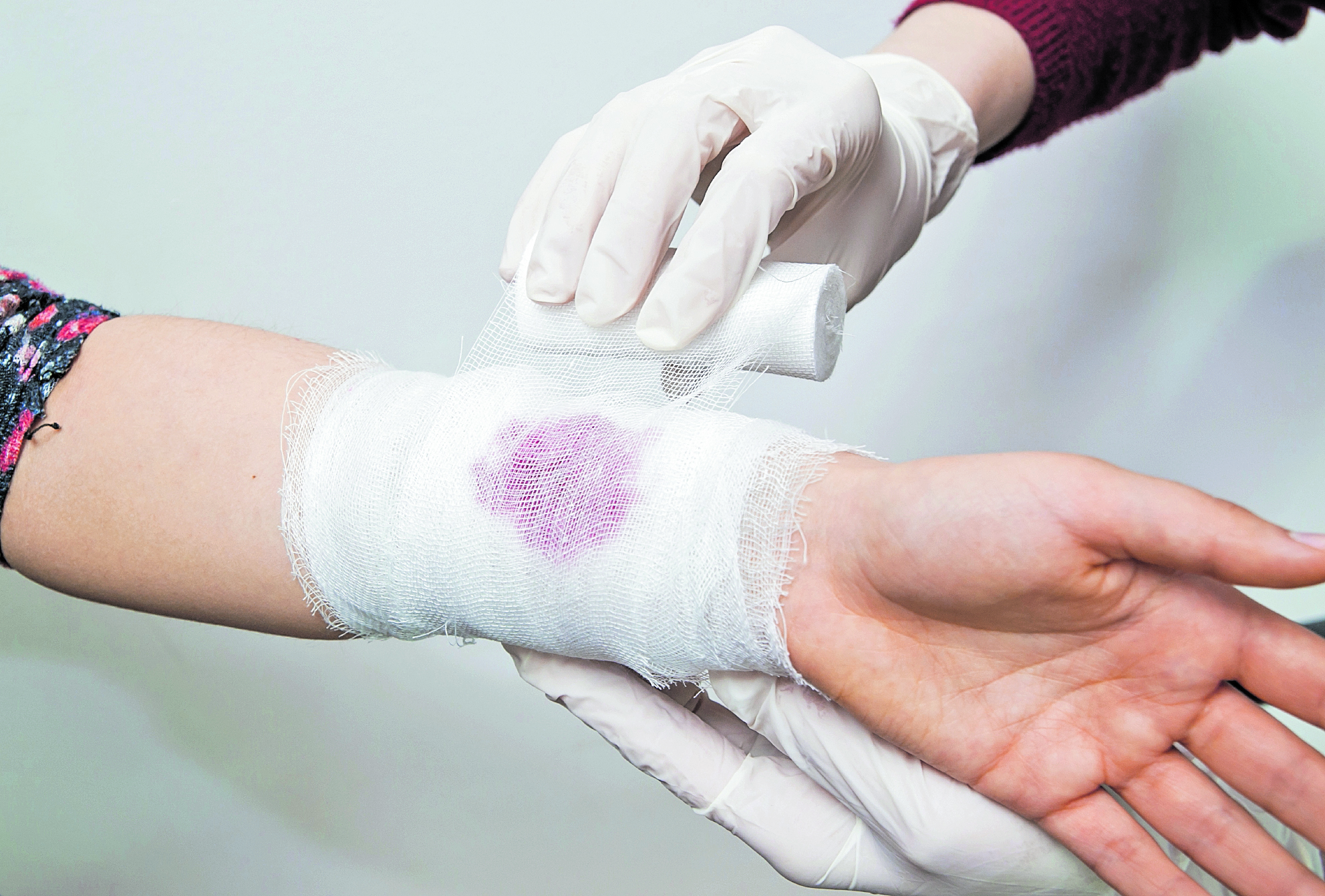 Mantener limpias y cubiertas las heridas, en cualquier parte del cuerpo, ayudará a reducir el riesgo de alguna infección. (Foto Prensa Libre Shutterstock). 