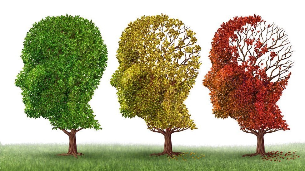 Los únicos medicamentos aprobados para el alzhéimer solo alivian algunos de los síntomas, parcial y temporalmente, pero no detienen el progreso de la enfermedad.
