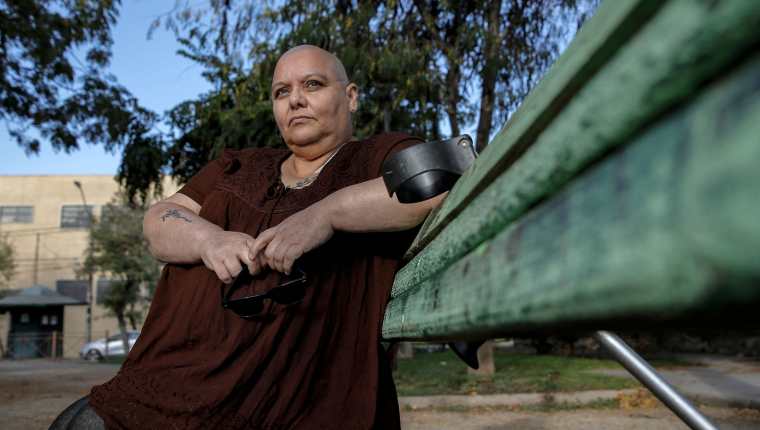 La activista chilena por el derecho a una muerte digna, Cecilia Heyder, quien padece cáncer metastásico, lupus y un trastorno sanguíneo. (Foto Prensa Libre: AFP)