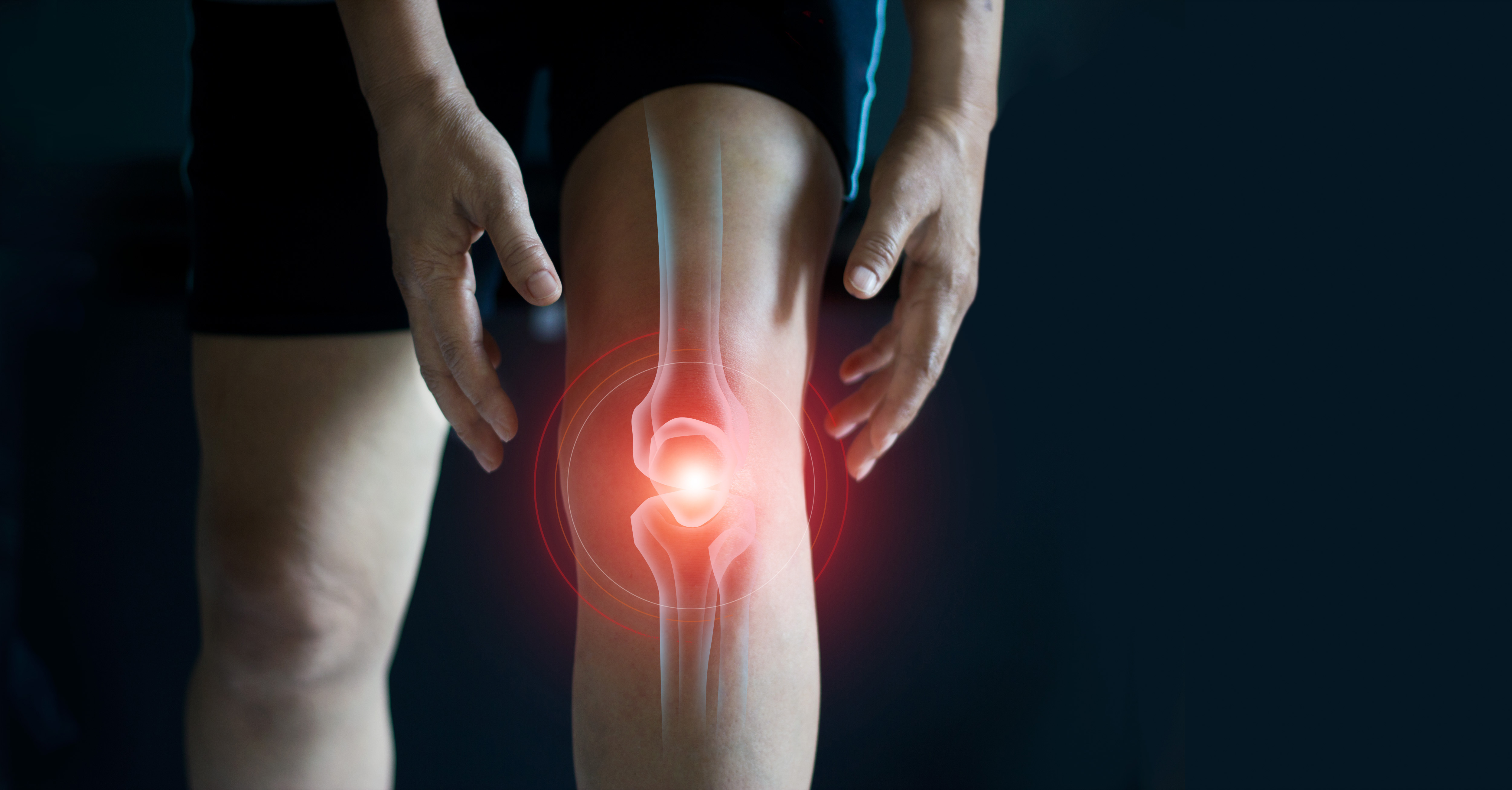 Проблемы с коленным суставом