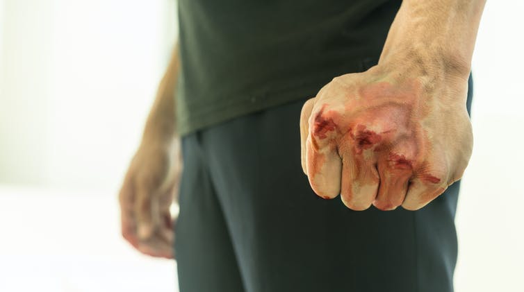 Shutterstock / christinarosepix