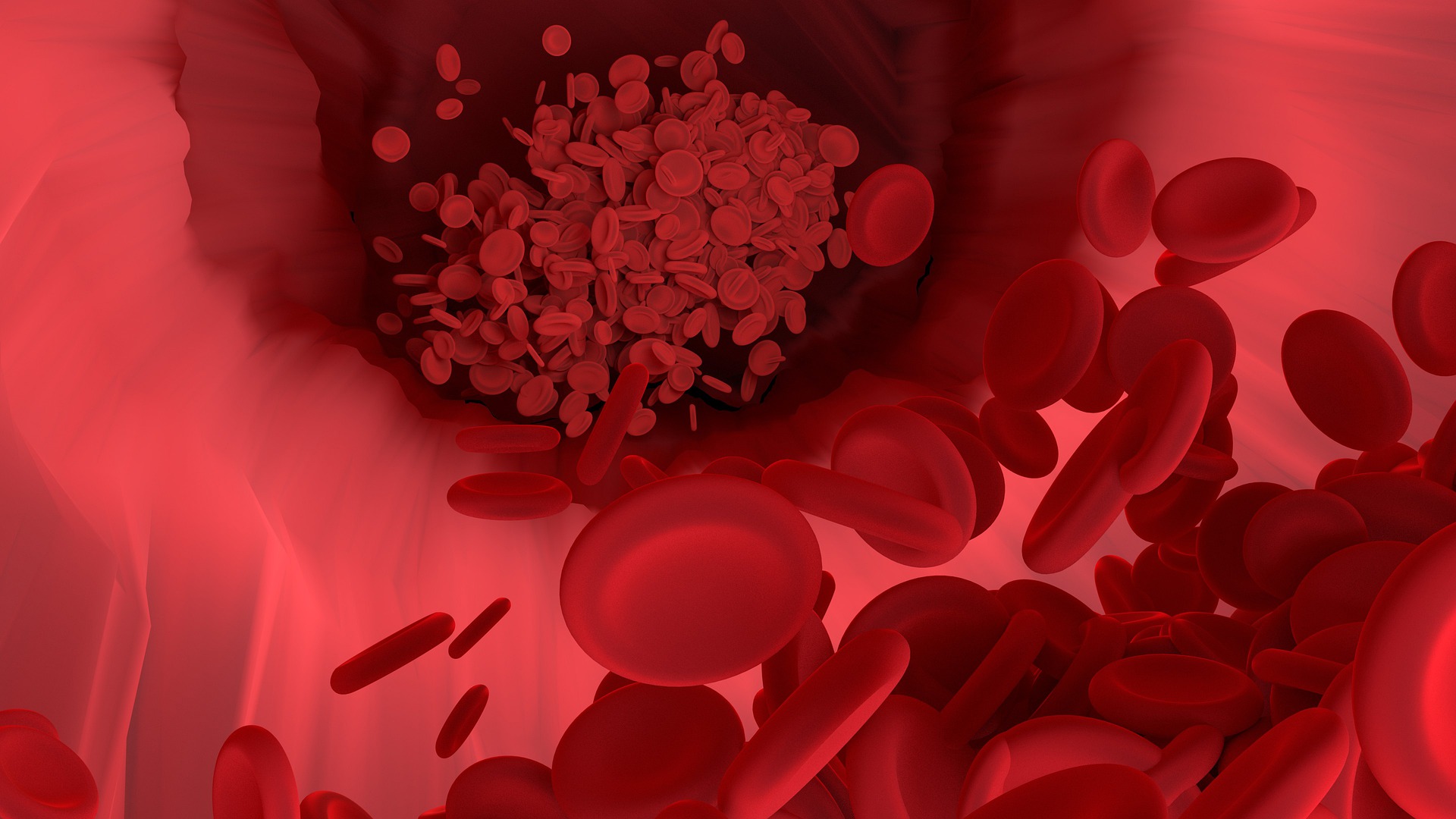 Estudio muestra evidencia adicional de que las personas con ciertos tipos de sangre pueden tener más probabilidades de contraer coronavirus. (Foto Prensa Libre: Pixabay)