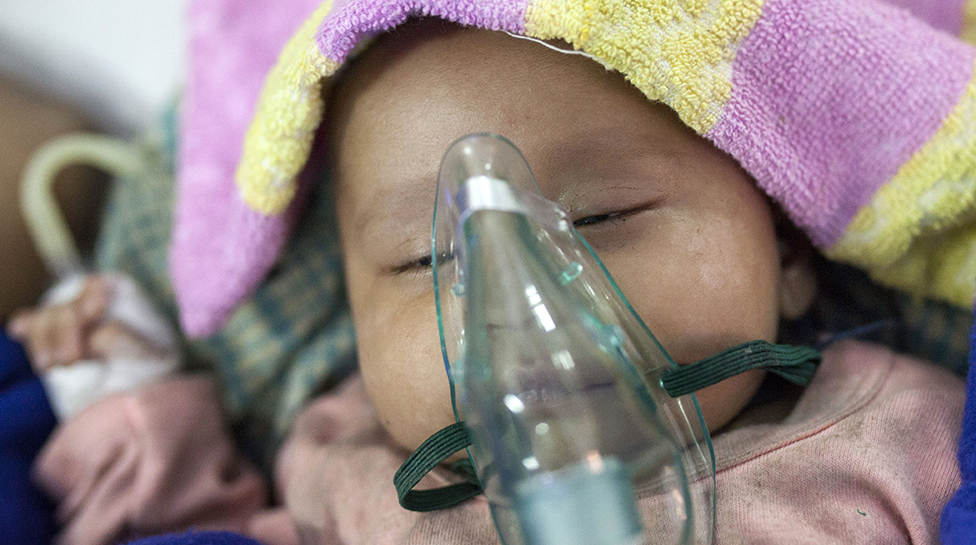 Los ingeniosos inventos que salvan la vida de niños que necesitan oxígeno desesperadamente