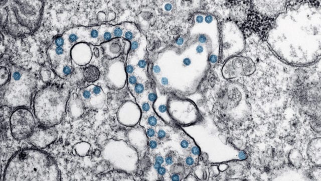 Imagen de microscopio electrónico de transmisión del virus de Covid-19. Foto: CDC.