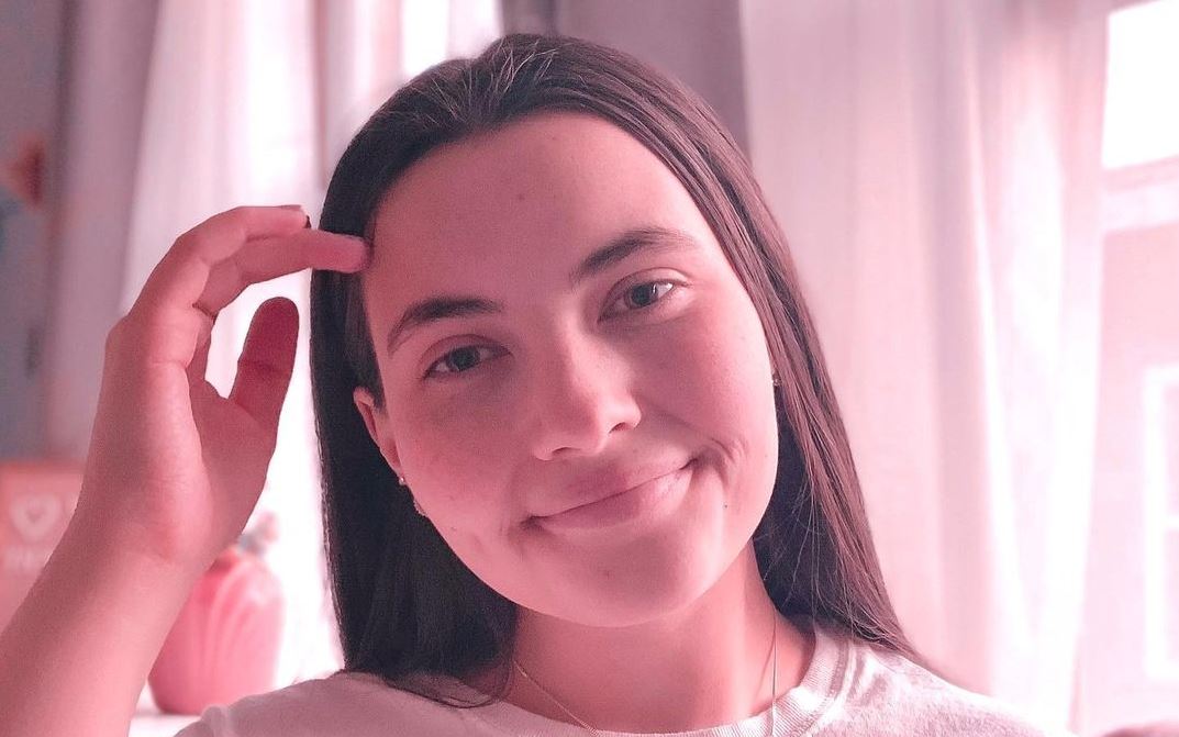 Una joven de 22 años es alérgica al agua.
(Foto Prensa Libre: Instagram)