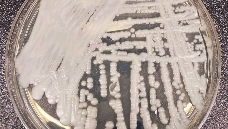 Candida auris es un hongo emergente que presenta una grave amenaza para la salud mundial. (Foto Prensa Libre: Tomada de wikipedia)
