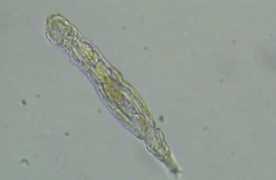 El rotífero bdelloidea, nombre de esta pequeña criatura, se reproduce asexualmente y puede subsistir a temperaturas bajo cero. (Foto Prensa Libre: Zero Hedge)