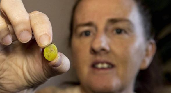 El insólito caso de una mujer que sufrió dolores en su nariz por 37 años y una prueba PCR reveló la sorprendente razón