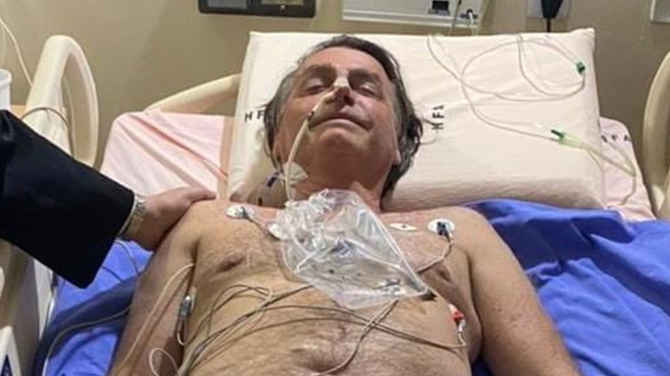 Jair Bolsonaro fue internado en un hospital de Sao Paulo. JAIR BOLSONARO