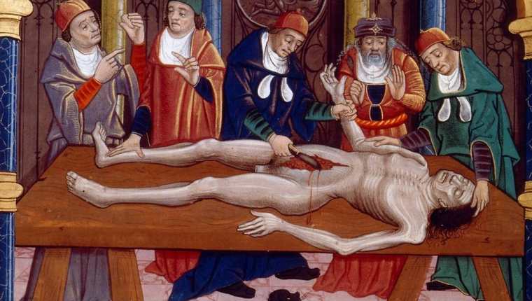 Ilustración medieval de una autopsia realizada en la Edad Media. Del manuscrito francés "Las propiedades de las cosas" por Bartholomaeus Anglicus, finales del siglo XV. imágenes falsas