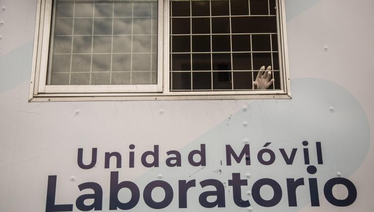 AME1615. CIUDAD DE GUATEMALA (GUATEMALA), 22/04/2021.- Una persona saca la mano en un laboratorio móvil en el mercado 