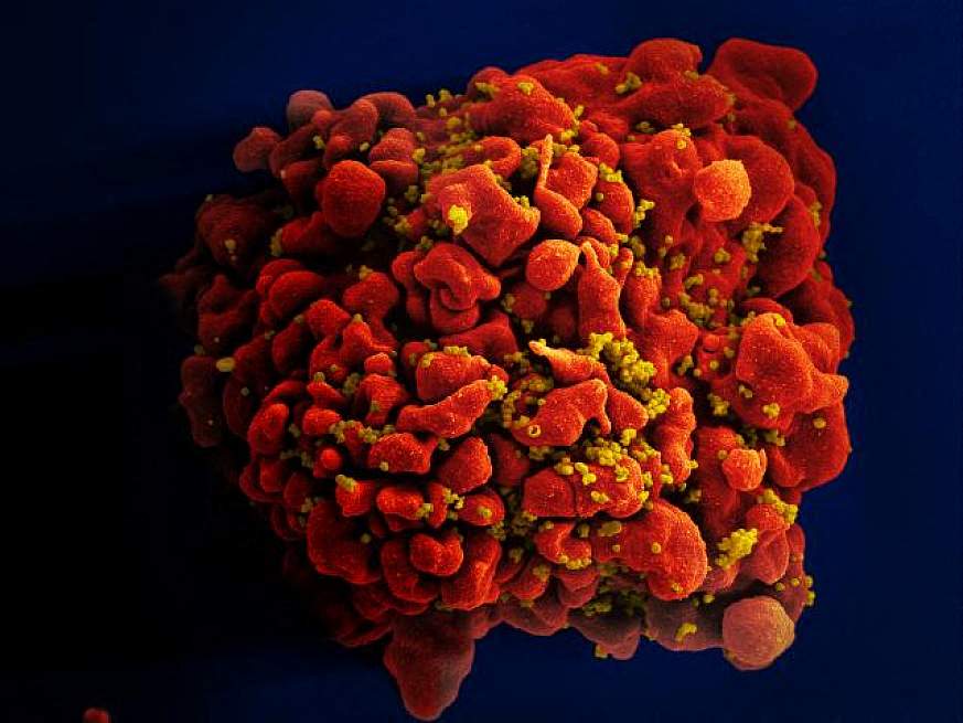La muy esperada vacuna contra el VIH de J&J no demostró una protección adecuada en un ensayo clínico en el que participaron más de 2 mil 600 mujeres. (Foto Prensa Libre: AFP)