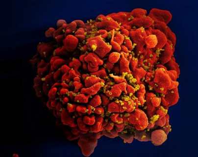 Fracasa ensayo de vacuna contra VIH de Johnson & Johnson, según autoridades sanitarias de EE. UU.