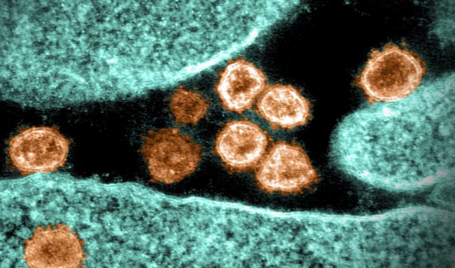 Una variante del coronavirus vista al microscopio. (Foto: AFP)
