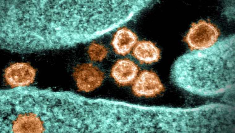 Una variante del coronavirus vista al microscopio. (Foto: AFP)