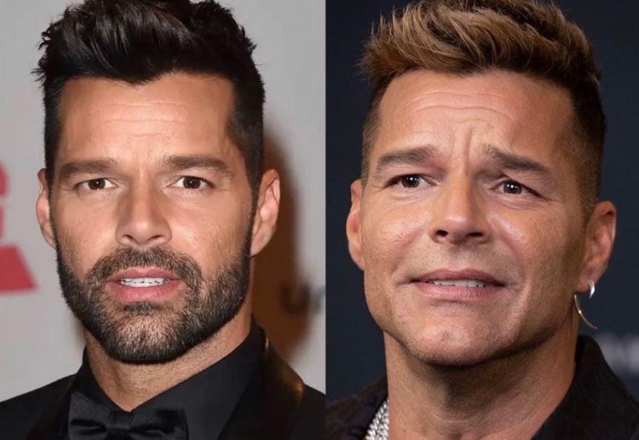 ¿Se hizo un retoque estético? Ricky Martin revolucionó las redes sociales al mostrar su nuevo rostro