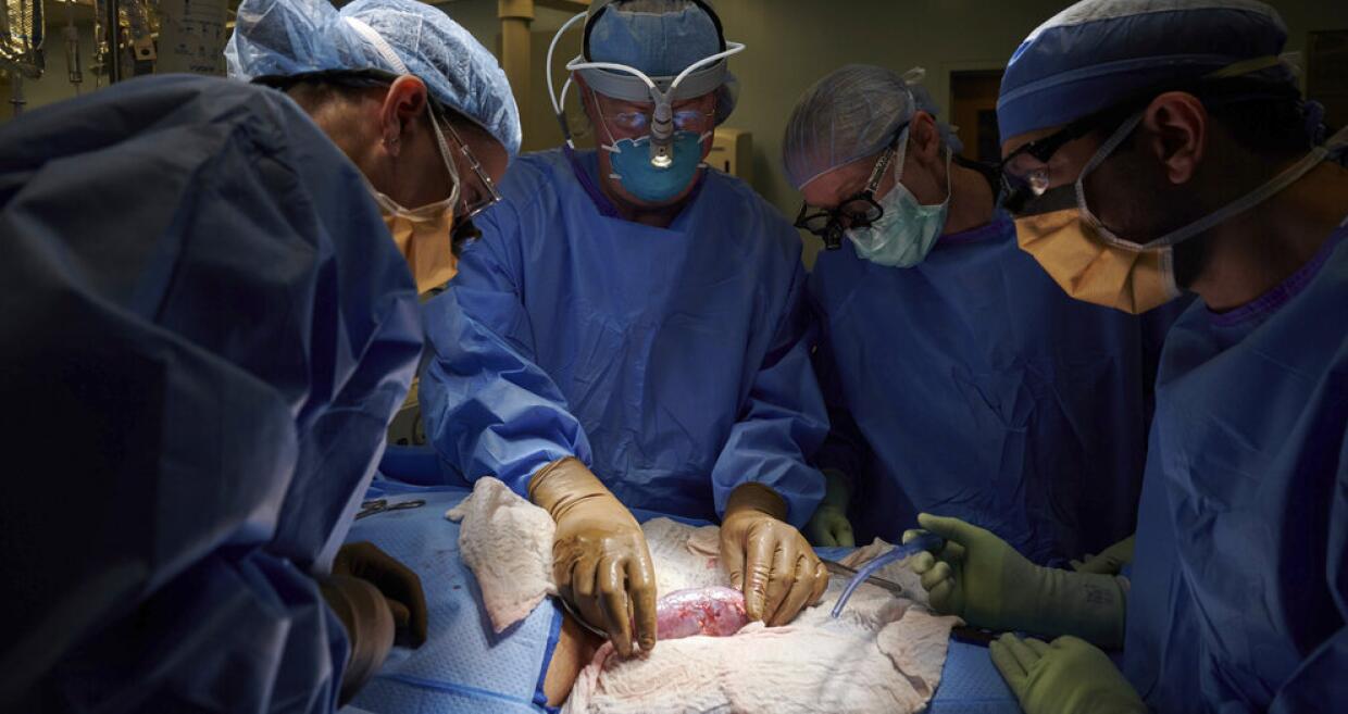 Médicos estadounidenses lograron unir temporalmente un riñón de cerdo en un cuerpo humano. (Foto Prensa Libre: Univisión/AP) 