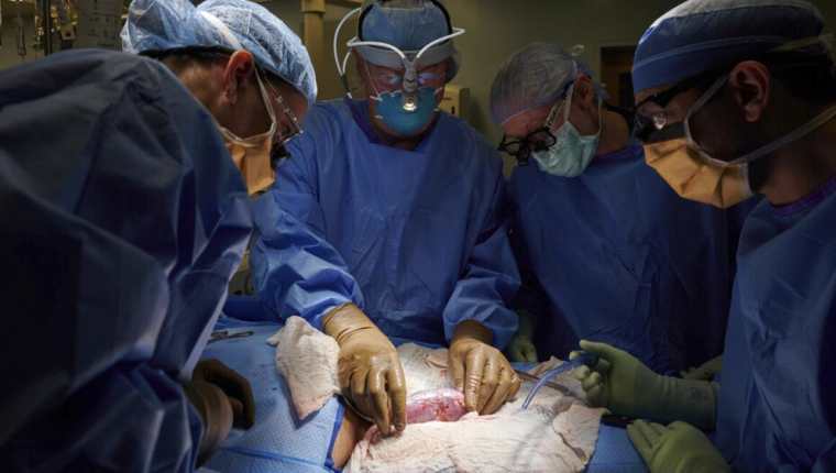 Médicos estadounidenses lograron unir temporalmente un riñón de cerdo en un cuerpo humano. (Foto Prensa Libre: Univisión/AP) 