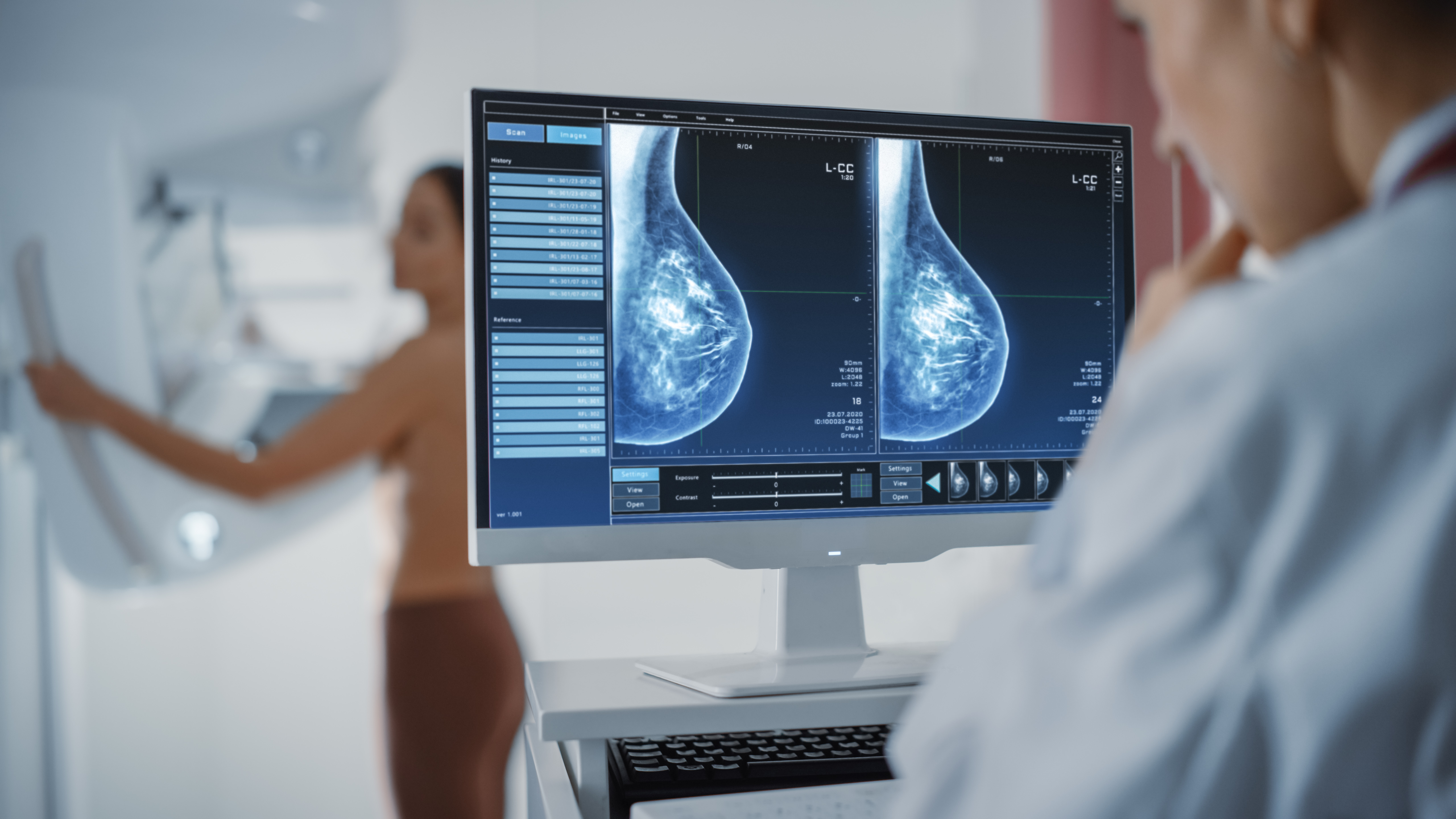 Acudir a un procedimiento, como una mamografía, para la detección temprana del cáncer de mama puede salvar la vida. (Foto Prensa Libre: Shutterstock).