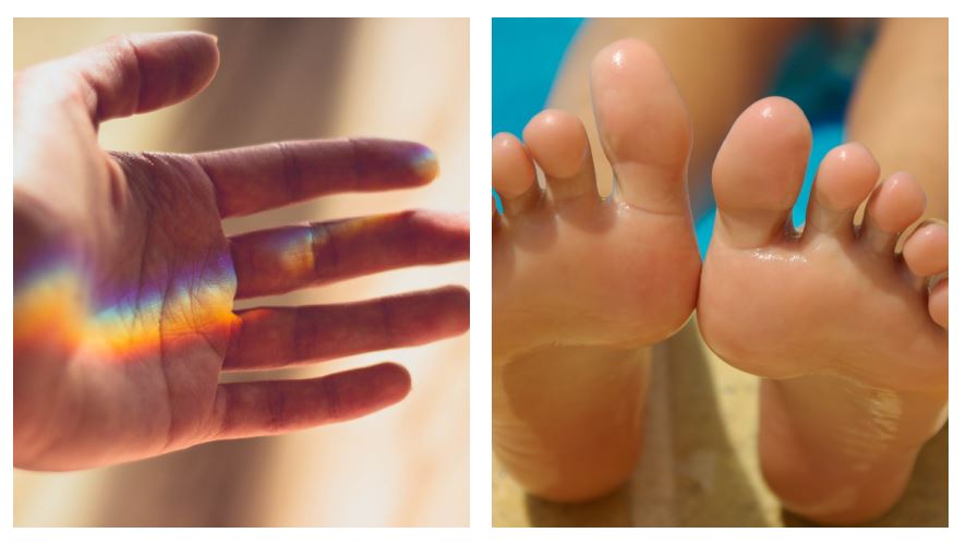 Lesiones en manos y pies podrían ser un efecto de la respuesta inmune a covid. (Foto Prensa Libre: Pixabay)
