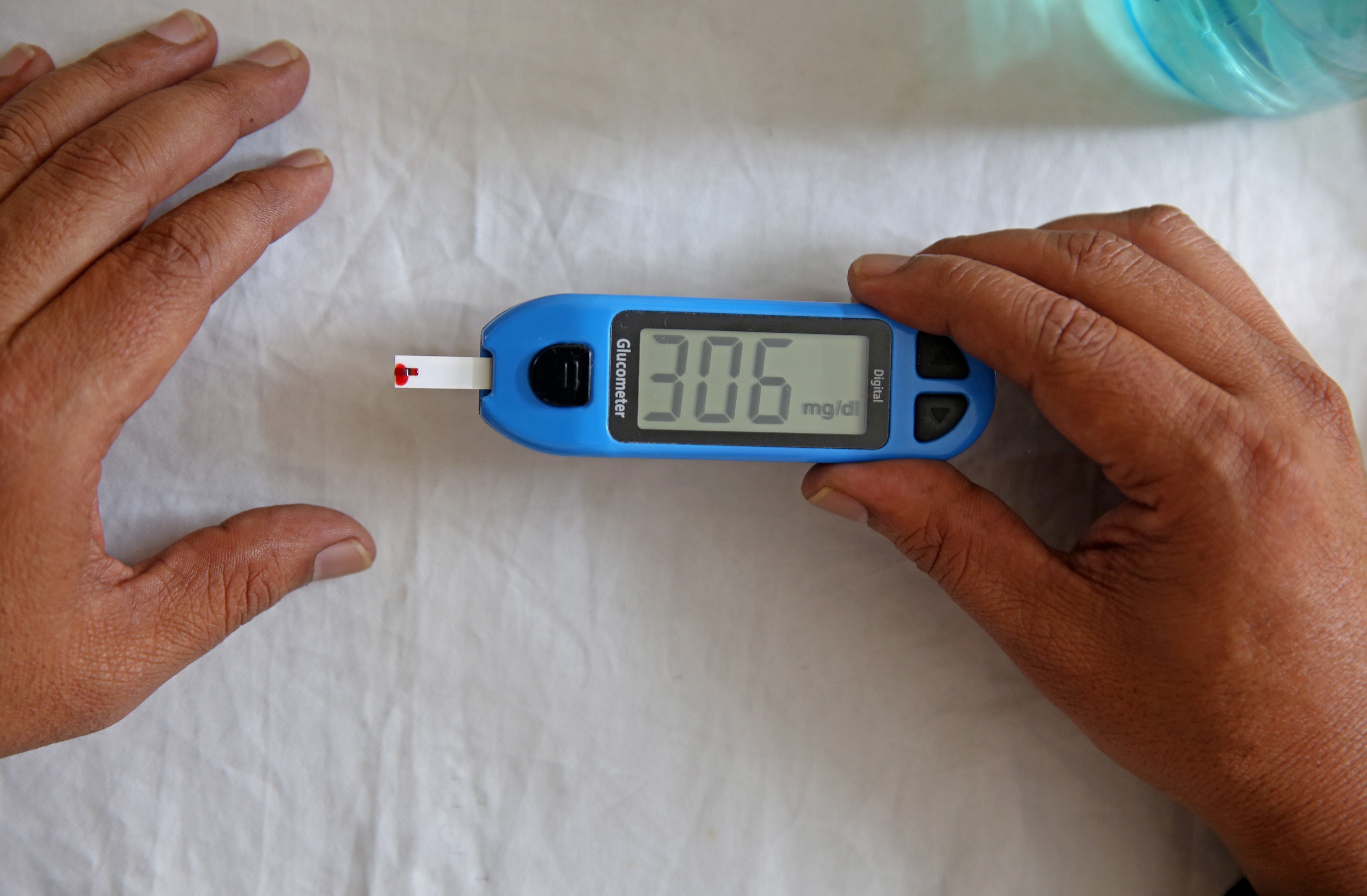 Bangalore (India), 14/11/2021.- A health official checks the sugar level reading of a person during free diabetes awareness camp on the occasion of 'World Diabetes Day' in Bangalore, India, 14 November 2021. The walk was aimed to create awareness about diabetes and free access to diabetes care and prevention. 14 November is observed as World Diabetes Day. (Día, Mundial, Concienciación, Autismo) EFE/EPA/JAGADEESH NV
