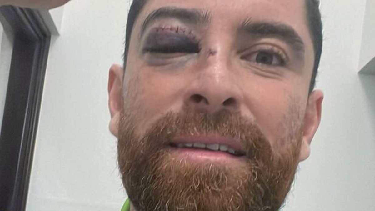 Márquez celebró con el ojo morado el pase a la final de Primera División pese a las intimidaciones sufridas en la cancha de Mictlán