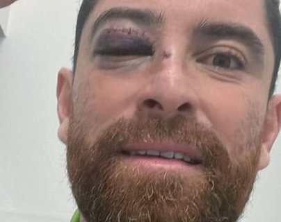 Márquez celebró con el ojo morado el pase a la final de Primera División pese a las intimidaciones sufridas en la cancha de Mictlán