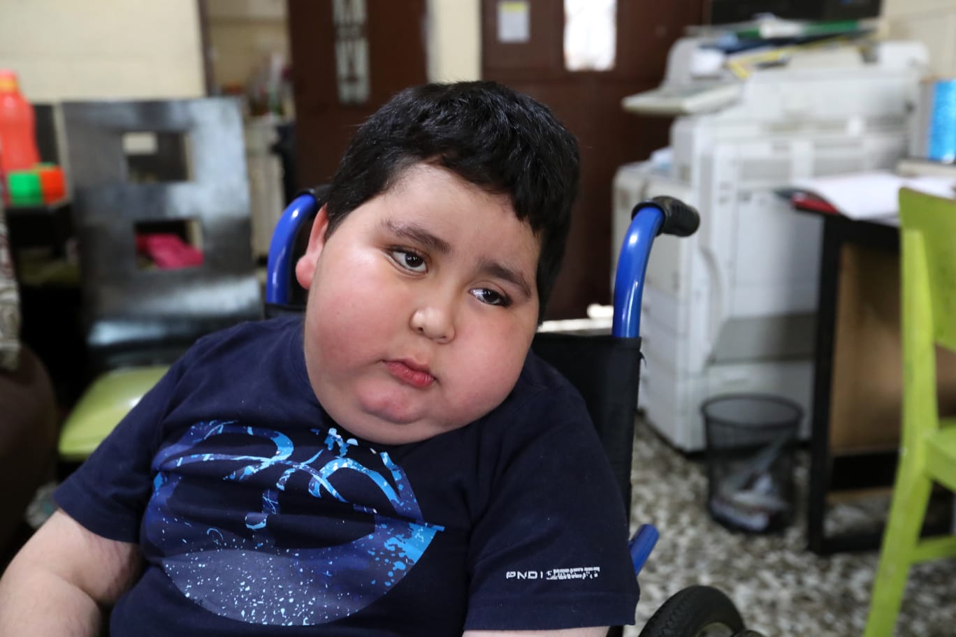 El pequeño Sebastián necesita ayuda para tratar el raro padecimiento. (Foto Prensa Libre: María Reneé Barrientos).