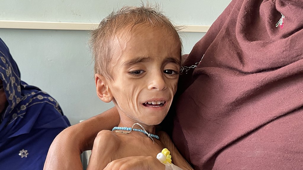 “Una joven rogaba que la mataran a ella y a su bebé”: el hospital en Afganistán donde los niños mueren de desnutrición