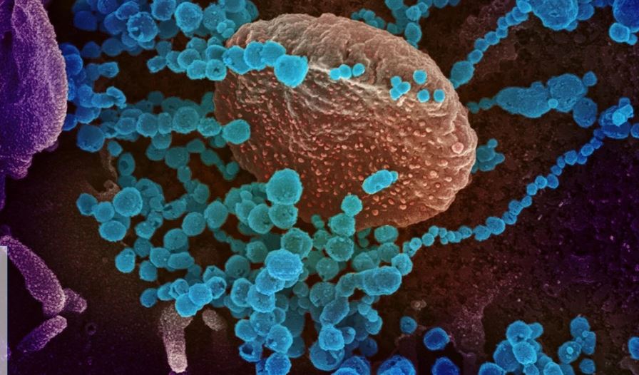 Científicos creen que las variantes del coronavirus podrían originarse en personas bajas en inmunidad. (Foto: AFP)