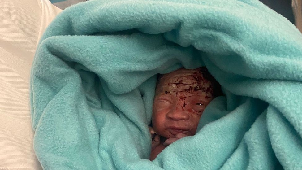 Encuentran un bebé recién nacido abandonado en el cubo de basura del baño de un avión