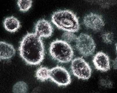 OM-85, la bacteria que podría evitar la infección y transmisión de covid-19