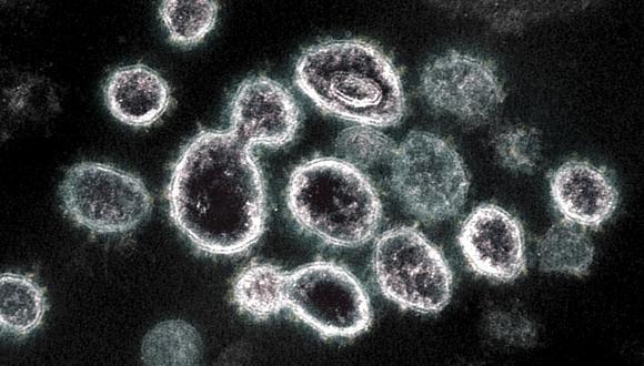 El estudio propone neutralizar el coronavirus con otra bacteria. (Foto: AFP)
