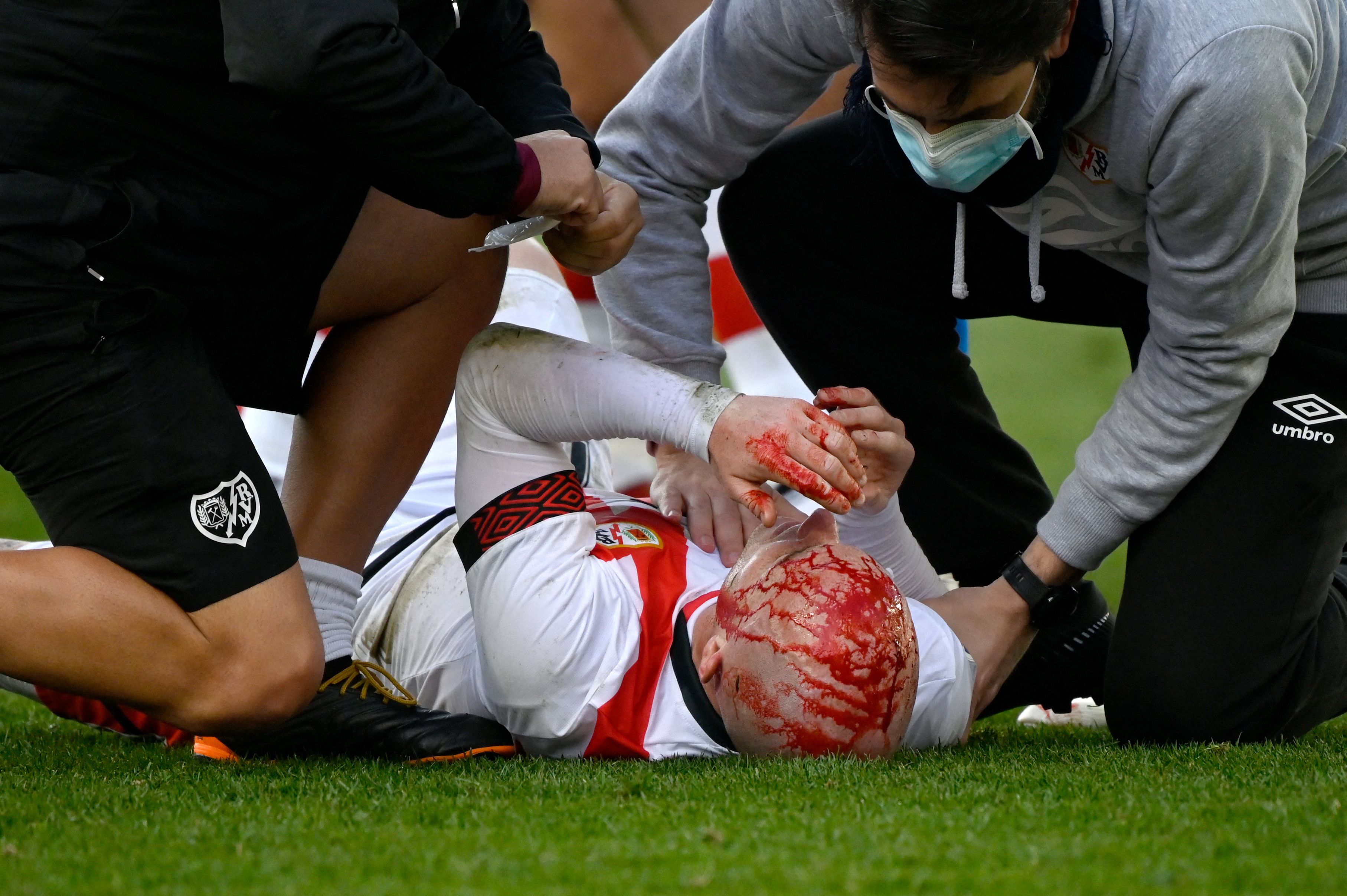 El jugador del Rayo Vallecano Isi Palazon es atendido por personal médico tras lesionarse ante el Real Betis. (Foto Prensa Libre: AFP)