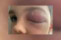 "Ojo Covid": El extraño caso de un niño que casi pierde la visión después de contagiarse de coronavirus