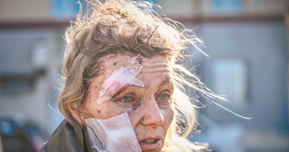 Olena Kurilo: Cuál es la historia de la mujer que protagoniza una de las fotos más impactantes del conflicto entre Rusia y Ucrania