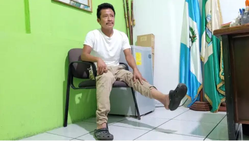 Juan José López muestra la herida tras lanzarse de la cruz y asegura que aún no ha recibido atención médica. (Foto Prensa Libre: Marvin Túnchez) 