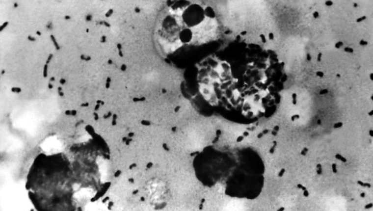 La bacteria Yersinia pestis causa la pesta bubónica.
GETTY IMAGES
