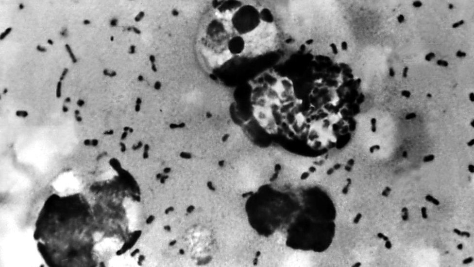 La bacteria Yersinia pestis causa la pesta bubónica.
GETTY IMAGES
