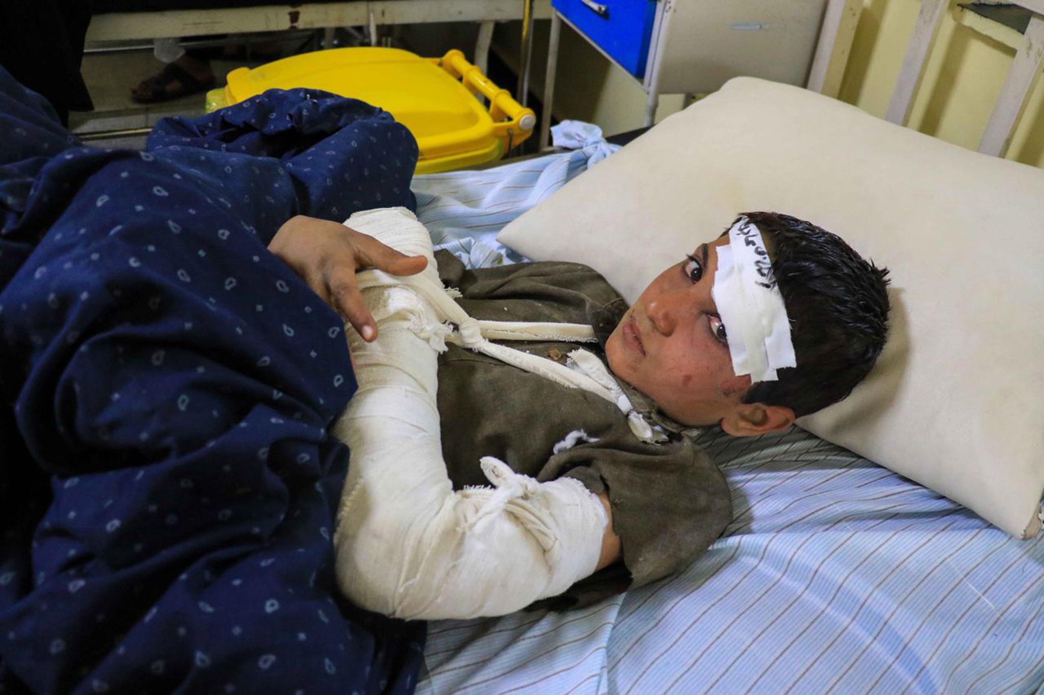 Uno de los heridos recibe atención médica en el hospital de Paktia, Afganistán  por el potente terremoto que afectó esa región este 22 de junio de 2022 con 
 saldo de más de mil muertos.  (Foto Prensa Libre: EFE). 