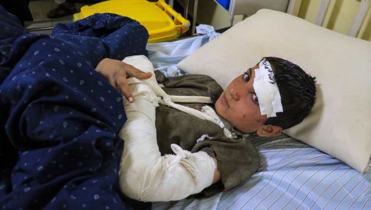 Uno de los heridos recibe atención médica en el hospital de Paktia, Afganistán  por el potente terremoto que afectó esa región este 22 de junio de 2022 con 
 saldo de más de mil muertos.  (Foto Prensa Libre: EFE). 