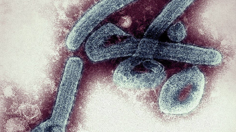 La preocupación por el primer brote en Ghana del mortal virus de Marburgo, de la misma familia que el ébola