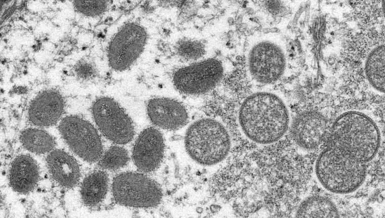 La viruela del mono vista bajo un microscopio electrónico.
CDC/REUTERS
