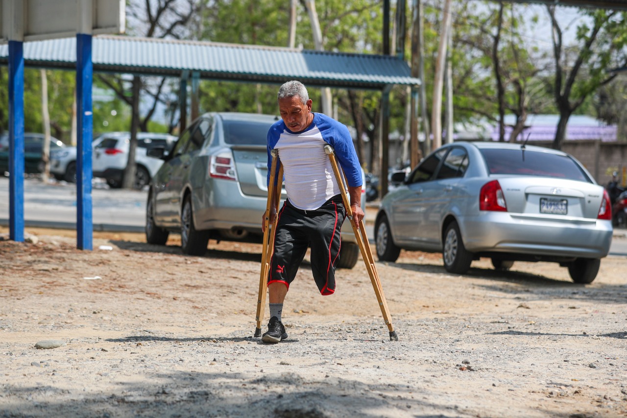 Óscar Osoy, guatemalteco de 65 años, se dedicaba a la jardinería y el año pasado perdió la pierna izquierda. Posiblemente, tras la picadura de araña violín (Loxosceles laeta). Tras varias visitas a centros de salud y doctores particulares, se le recomendó la amputación de su pierna y, en cuestión de meses, su vida tuvo un giro de 180 grados y todo cambió, ya no podía valerse por sí mismo y dependía de las muletas o silla de ruedas para trasladarse. (Foto Prensa Libre: Juan Diego González)