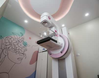 La mamografía debe realizarse una vez al año a partir de los 40 años.  (Foto: Juan Diego Gonzalez)