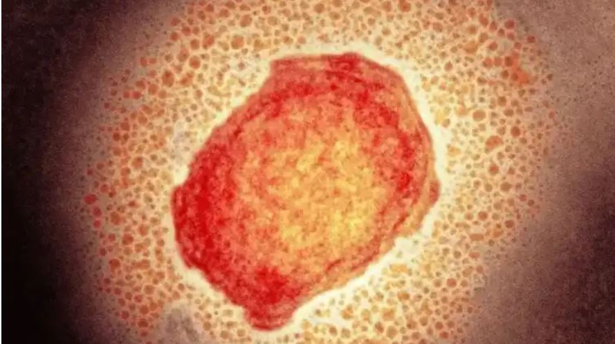 Vista al microscopio del virus de la viruela del monto. (Foto: Hemeroteca PL)