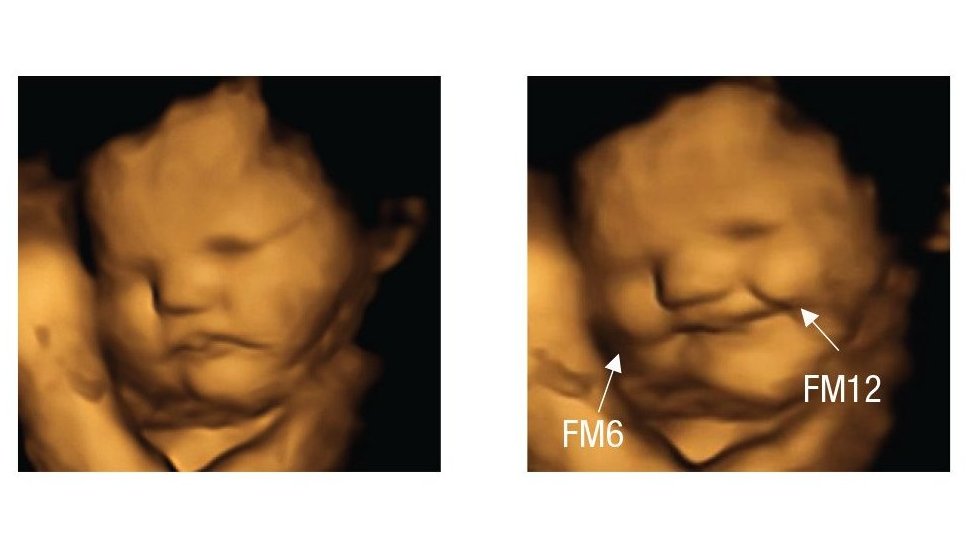 Así reaccionó este feto 20 minutos después de que su mamá comiera una capsula de zanahoria en polvo. (FETAL AND NEONATAL RESEARCH LAB, DURHAM UNIVERSITY)