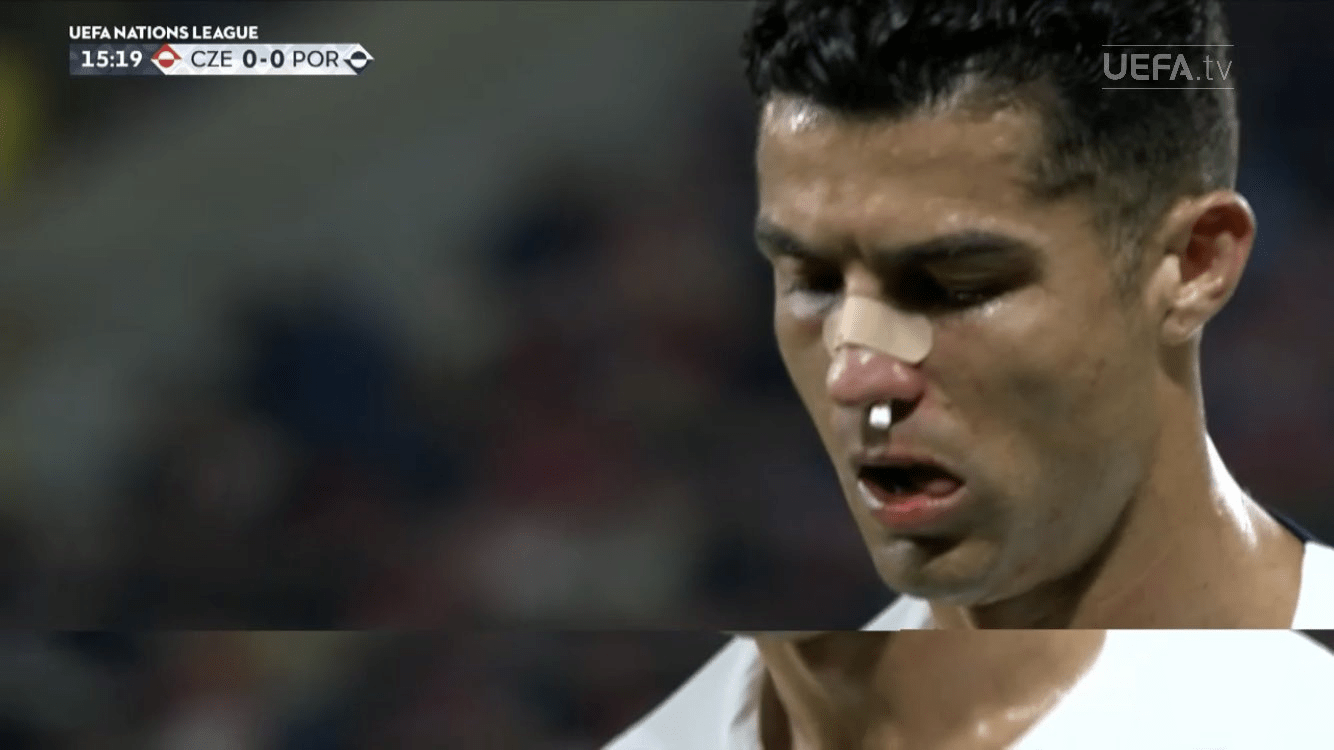 Cristiano Ronaldo se llevó un fuerte golpe en el partido ante República Checa. Foto Prensa Libre (UEFA)