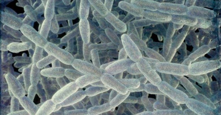 La bacteria de la legionella vista al microscopio. (Foto: AFP)