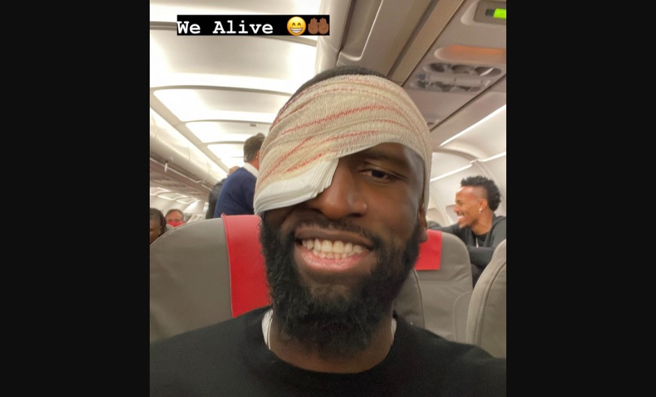 "Estamos vivos", escribió Rudiger en una historia de Instagram tras el partido contra el Shakhtar en el que sufrió un duro golpe cerca del ojo. (Foto Prensa Libre: Instagram/Antonio Rudiger)